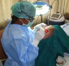 Ultra Thin Epidermal Grafting